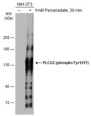 Western Blot: PLC-gamma 2 [p Tyr1217] Antibody [NBP3-13270]